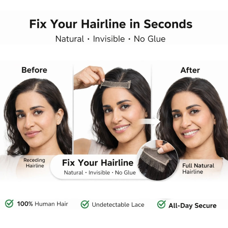 ✅Instantly Fix Your Hairline — No One Will Ever Know
